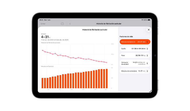 Historial de fibrilación auricular y ejercicio