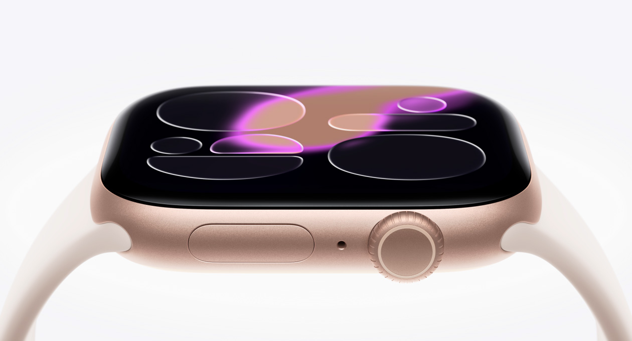 Apple Watch Series 11, zeltrozā krāsa, alumīnija ietvars, Responsive Art ciparnīca, labais sāns, Digital Crown, mikrofons, sānu poga, sporta siksniņa, iesārta krāsa