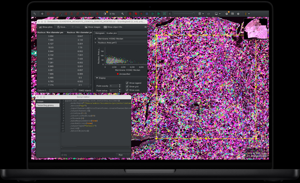 MacBook Pro 螢幕展示 QuPath 和 Instanseg